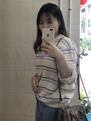 xyz的第一张照片--福建残疾人相亲网