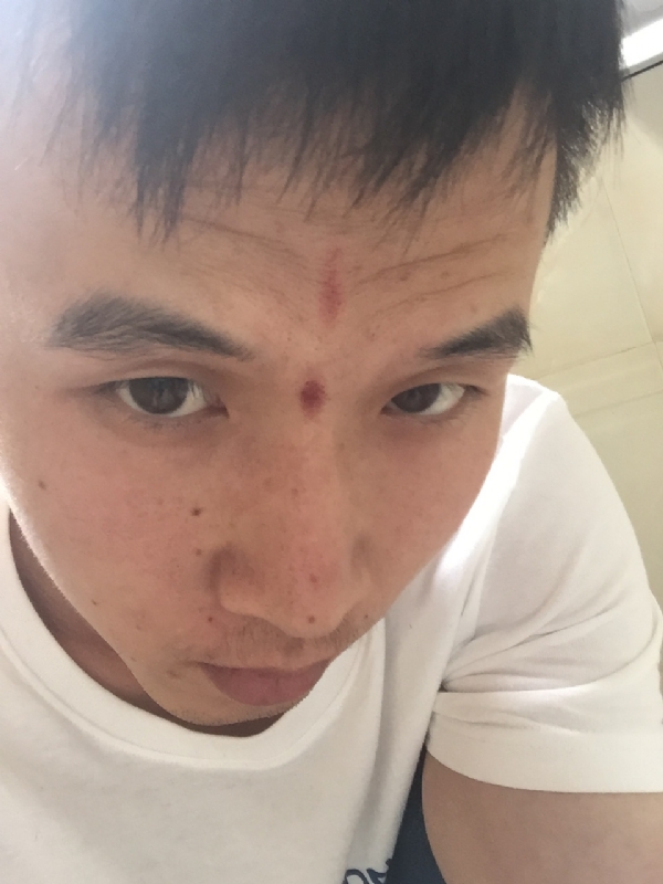 爱晴的第一张照片--福建残疾人相亲网